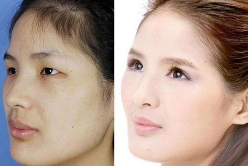 整容女图片,揭秘整容女背后的故事
